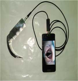 Smart Trach